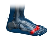 Χειρουργική κάτω άκρου