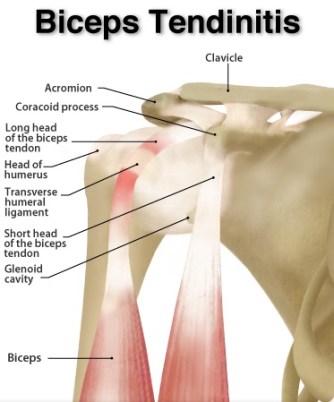 E.Βλάβες μακράς κεφαλής δικεφάλου