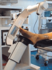x-ray foot control